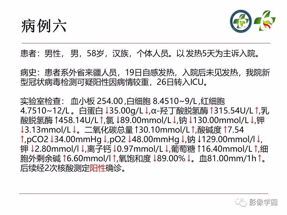 最新肺部感染病例探討及某某觀點(diǎn)分析