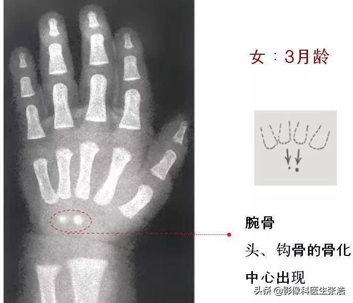 女孩骨齡對(duì)照表最新解讀及指南